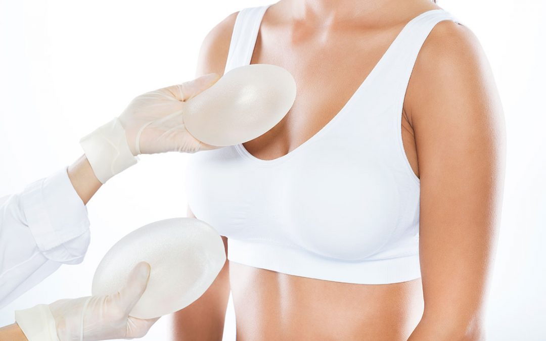 Breast Augmentation v Mastopexy