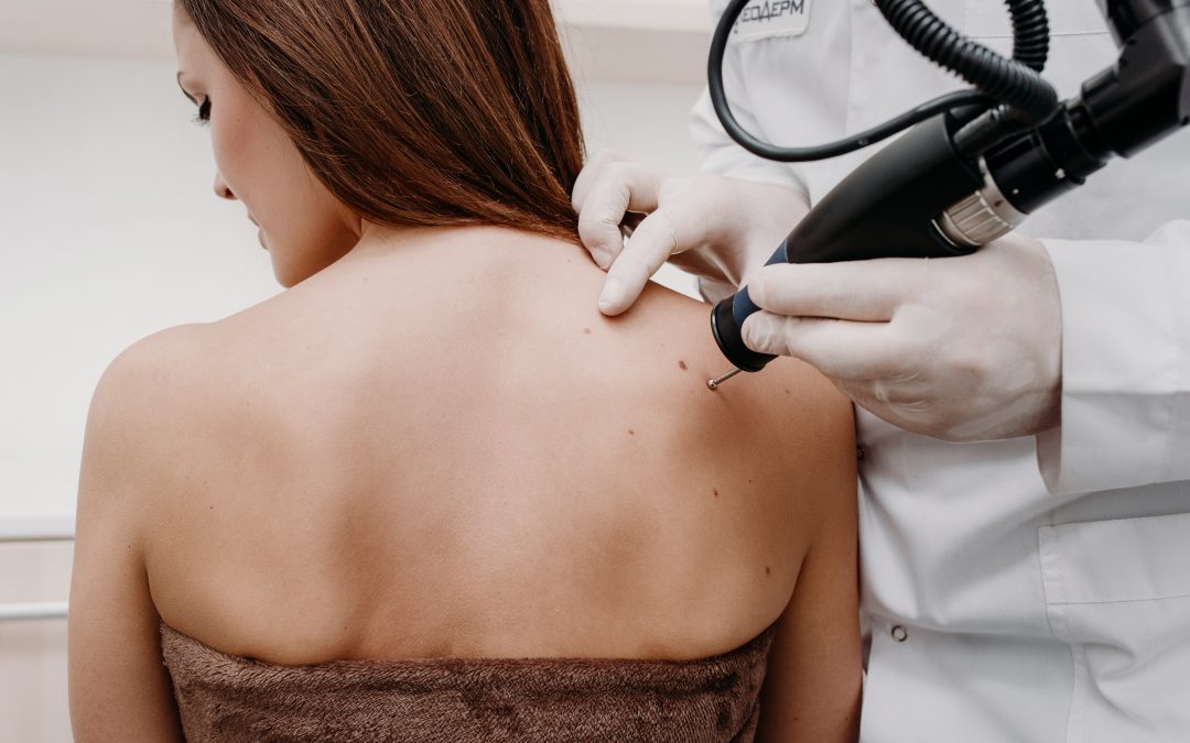 ‘See and Treat’ service for Skin Lesion Removal