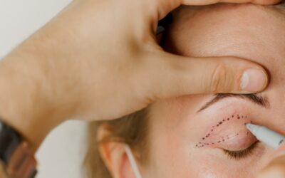 Lower Blepharoplasty vs Upper Blepharoplasty: Which Procedure Do You Need?