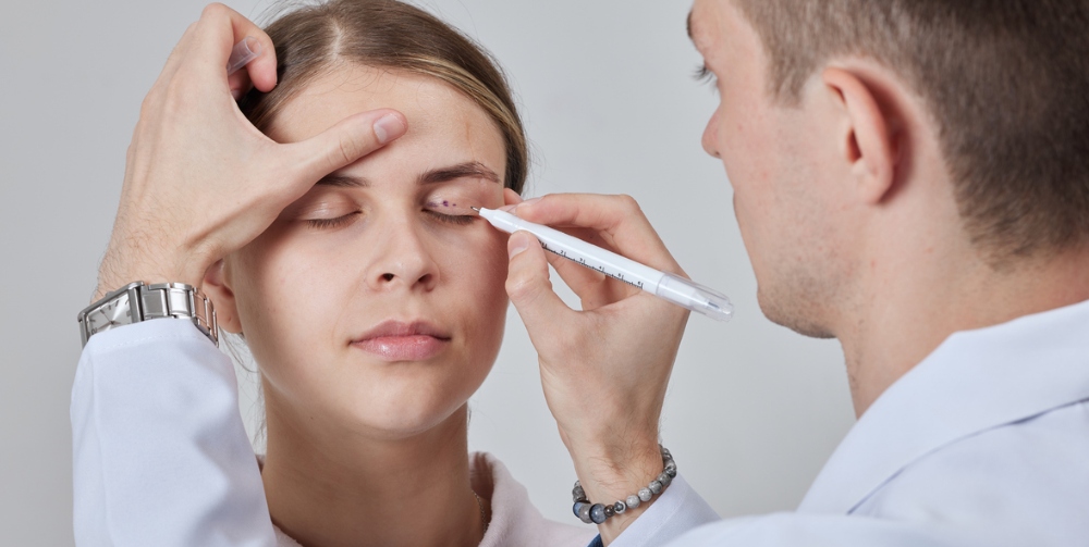 Blepharoplasty of a woman marking on her face before plastic surgery