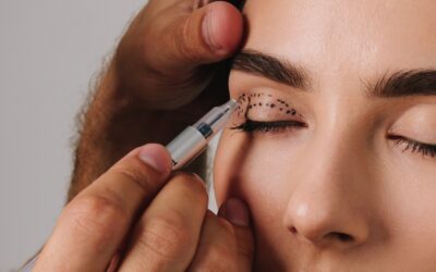 Blepharoplasty Results: What to Expect Before and After Surgery
