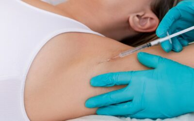 Botox For Sweating: How It Can Help and What To Expect