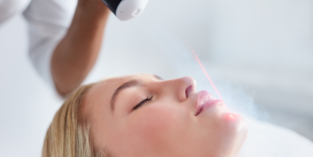 Is Laser Skin Resurfacing Worth It? Benefits, Results, and Treatment Areas