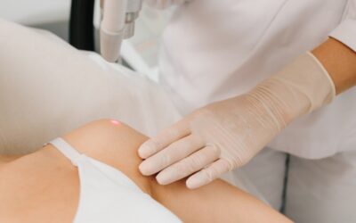 Is Skin Lesion Removal Safe? A Simple Guide for Patients
